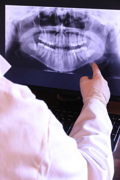 Best Emergency Tooth Extraction in Wallis, TX