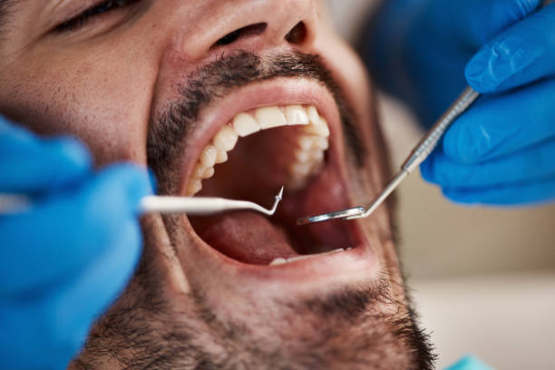 Best After-Hours Emergency Dentist in Wallis, TX