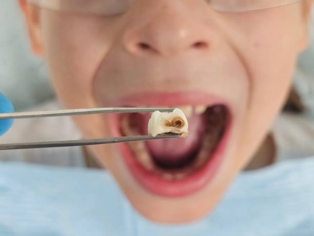 Best Walk-In Emergency Dentist in Wallis, TX